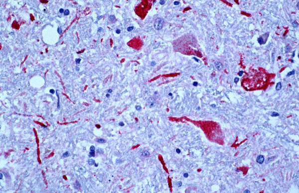 Positive staining of viral antigens in neurons and neuronal processes. Immunoalkaline phosphate staining, naphthol fast red substrate with light hematoxylin counterstain. Original magnification, X100.
