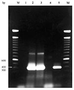 Thumbnail of Agarose gel electrophoresis of results of PCR amplification of Ehrlichia chaffeensis nss rRNA gene from whole blood samples of coyotes numbers 9-11.* Lane 1= negative control (no DNA); Lane 2= coyote 9 (+); Lane 3= coyote 10 (+); Lane 4= coyote 11 (-); Lane 5 = positive control (E. chaffeensis-infected DH82 cells). M = 100-bp DNA ladder (Life Technologies, Rockville, MD).* * Ehrlichia forward primer ECC (5'-AGAACGAACGCTGGCGGCAAGC-3') and Ehrlichia reverse primer ECB (5'-CGTATTACCGCG