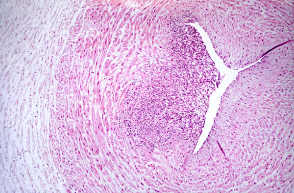 Figure 1 - Testing Umbilical Cords for Funisitis due to Treponema ...