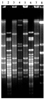 Thumbnail of Four distinct Haemophilus influenzae isolates from one child during a sampling period. Lanes 1-8: H. influenzae isolates collected from child no. 32 at the third sampling period.