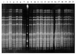 Thumbnail of Example of S. pneumoniae isolates collected from child no. 37 during four sampling periods. Lane 1: Isolate collected at week 1; lanes 2-3: isolates collected at week 2; lanes 4-7, 9-13: isolates collected at week 3; lane 8: low molecular weight lambda ladder; lanes 14-21: isolates collected at week 4.