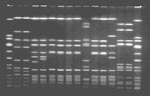 Thumbnail of Pulsed-field gel electrophoresis profiles of Sma I-digested chromosomal DNA. Lanes 1 and 16, NCTC 8325 standard; lane 2 and 3, methicillin-sensitive Staphylococcus aureus (MSSA) nasal isolates from food preparer A; lanes 4 and 5, MSSA nasal isolates from food preparer B; lane 6, methicillin-resistant S. aureus nasal isolate from food preparer C; lane 7, MRSA stool isolate from family member A; lane 8, MRSA stool isolate from family member B; lane 9, MRSA stool isolate from family member C; lanes 10 and 11, MSSA follow-up isolates from family member C; lane 12, MRSA isolate from slaw; lanes 13, 14, and 15, MSSA isolates from barbequed pork.