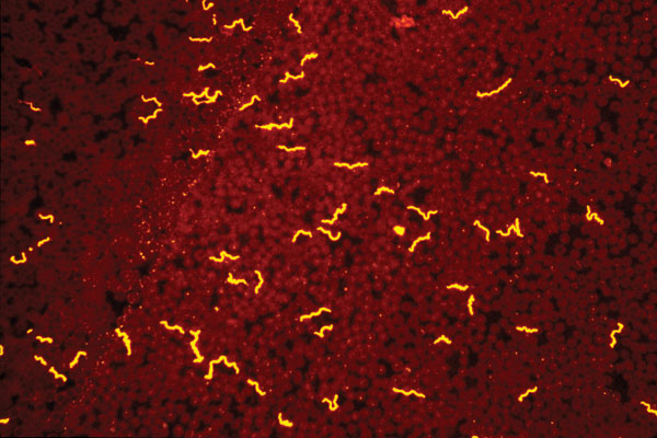 Borrelia hermsii visualized with an immunofluorescent stain in a thin blood smear of an experimentally infected mouse. Such recurrent, high densities of spirochetes circulating in the peripheral blood of small mammals allows for the acquisition of these bacteria by fast-feeding ticks that ingest a small volume of blood.