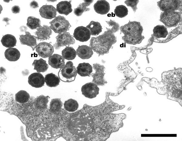 Hall’s coccus within Acanthamoeba polyphaga. Electron microscopy, magnification X 12,000, bar = 1 µm.