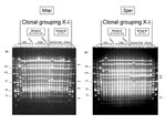Thumbnail of Two groups of pulsed-field gel electrophoresis patterns among NheI- and SpeI-digested chromosomal DNA from selected serogroup X Neisseria meningitidis strains isolated in Africa. Lane: strain: 1: D93 (ST188); 2: 1970; 3: 3187; 4: 3529; 5: D5; 6: LNP13407; 7: LNP14964; 8: LNP15040; 9: 97013; 10: 97014; 11: Z9413; 12: LNP14297; 13: LNP15061; 14: BF2/97; 15: BF5/97; 16: BF1/98; 17: Z7091; 18: Z8336; 19: Z9291. Molecular weight markers were loaded in the flanking lanes as indicated (L: low-range marker; M: midrange marker); their molecular weights are indicated at the left. Characteristic band differences are indicated on the right.