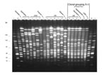 Thumbnail of Pulsed-field gel electrophoresis patterns of NheI-digested chromosomal DNA of selected serogroup X Neisseria meningitidis isolates from Europe and the United States, plus a prototype isolate from Ghana (lane 13). Lane: strain: 1: E26; 2: X4571; 3: X4890; 4: M2526; 5: M4222; 6: M3772; 7: LNP17351; 8: J88-603; 9: K89-1395; 10: L92-1413; 11: M98-253172; 12: M00-240465; 13: Z9291; 14: M98-252848; 15: M98-252718; 16: M99-240899; 17: X5967; 18: 860060; 19: M4370.