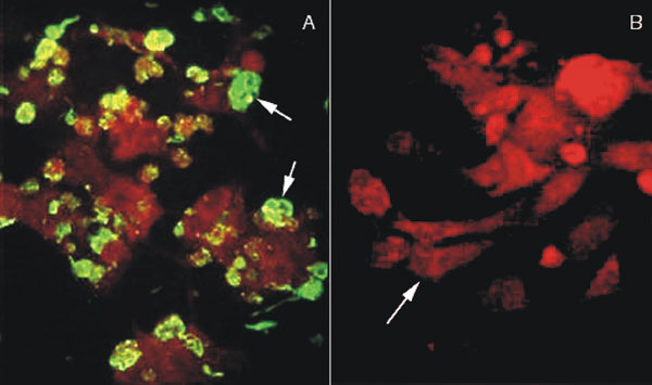 Immunofluorescence assay (IFA) of Vero E6 cells infected with Chilean hantavirus CHI-7913 isolate. A, IFA with seropositive human sera from a Chilean HPS patient; arrow shows infected Vero E6 cells expressing hantavirus antigens. B, IFA with seronegative human sera from uninfected control; arrow shows the negative IFA of Vero E6 cells infected with the CHI-7913 isolate.