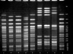 Thumbnail of Pulsed-field gel electrophoresis of O157 isolates from the Connecticut child and the deer meat showing XbaI and BlnI-digested genomic DNA. Lanes 1, 5, and 9 are Escherichia coli G5244, a standard strain used to characterize molecular size; lanes 2 (XbaI) and 6 (BlnI) are digests from the child’s O157 isolate, lanes 3 (XbaI) and 7 (BlnI) are digests from the deer meat O157 isolate, and lanes 4 (XbaI) and 8 (BlnI) are digests from an unrelated O157 patient. Numbers at right are molecular sizes (in base pairs).