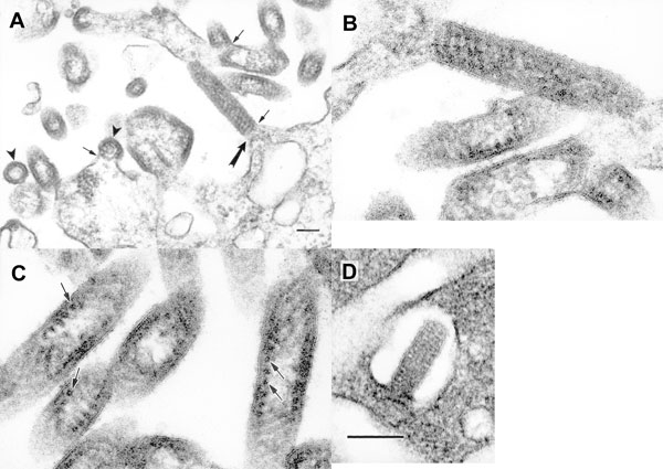 Ultrastructure of the new rhabdoviruses in infected Vero cells. A. Virions of isolate RI-175 budding from the surface of a Vero cell and from cell surface projections (arrows). Arrowheads mark cross-sections of virions. The virion indicated with a large arrow is enlarged in B. B. A virion of isolate RI-175 budding from host cell plasmalemma into an extracellular space. C. Details of the virion ultrastructure of isolate RI-175, showing spiral packaging of the nucleocapsid and its tubular structure in the cross-sections (arrows). D. A virion of the isolate CT-114 budding into an intracytoplasmic vacuole. Bar = 100 nm.
