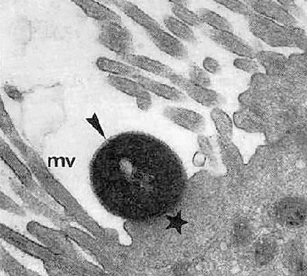Attaching and effacing lesion showing effacement of microvilli (mv) and pedestal (star) with adherent enteropathogenic Escherichia coli (EPEC) (arrow). Reprinted from reference 2, with permission of the director of American Society of Microbiology Journals.