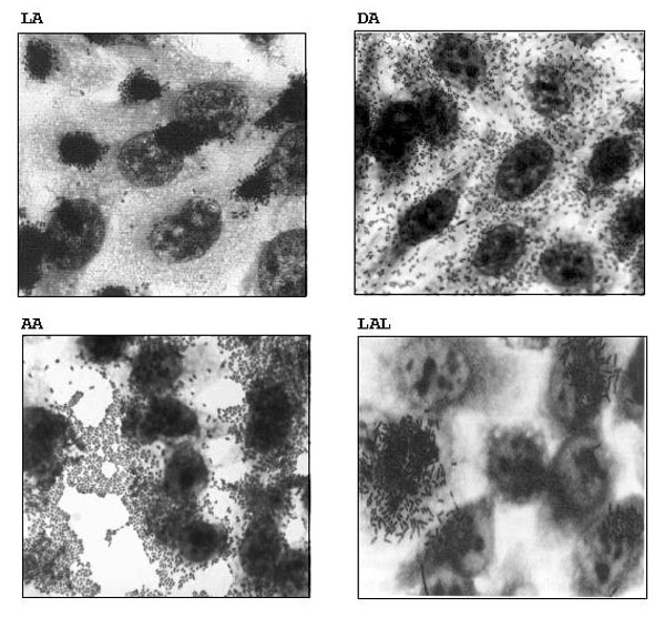 Adherence patterns of enteropathogenic Escherichia coli (EPEC) strains. Localized adherence (LA), diffuse adherence (DA), aggregative adherence (AA), and localized adherence-like (LAL). Magnification: X100.