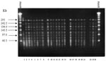 Thumbnail of Pulsed-field gel electrophoresis restriction fragment patterns of SmaI-digested genomic DNA obtained from glycopeptide-resistant Enterococcus faecium isolated at San Vicente de Paul Hospital, Bogotá, Colombia. Lane 1: a susceptible isolate of E. faecium; lane 2–24: Restriction patterns of the 23 VanA-type E. faecium. MWM, molecular weight marker.
