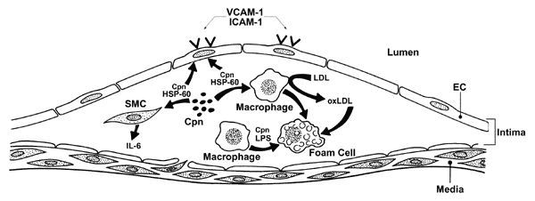 Possible direct effects of Chlamydia pneumoniae (Cpn) on atheromata. Cpn infection augments endothelial cell production of inflammatory cytokines and expression of adhesion molecules, e.g., vascular cell adhesion molecule (VCAM)-1, enhancing leukocyte recruitment to the arterial wall. Chlamydial endotoxin (LPS) may promote macrophage foam cell formation at the site. Chlamydial heat shock protein (HSP-60) may elicit proinflammatory functions from arterial wall macrophages, endothelium, and smooth
