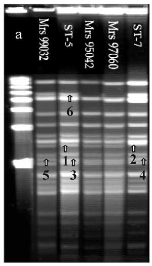Pulsed-field gel electrophoresis analysis of chromosomal DNA (ethidium bromide staining) of 104 strains isolated in Africa. DNA macrorestriction fragments were generated with BglII; 103 out of 104 strains showed closely related profiles. ST-5 pattern was the first pattern found in Africa and the most frequently isolated from 1988 to 1996. The second pattern was the ST-7 pattern, attributable to strains isolated more recently in Algeria, Cameroon, Sudan, Chad, and Niger. ST-7 pattern is closely r