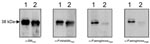 Thumbnail of Reactivity of Stenotrophomonas maltophilia flagellin with different antibodies. Lane 1, SMDP92 strain; lane 2, ATCC 13637. Blots containing whole cells extracts of SMDP92 and ATCC 13637 were reacted with antibodies against SMFliC, flagella of Proteus mirabilis, and anti-FlaA and anti-FlaB of Pseudomonas aeruginosa.