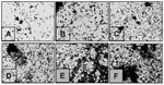Thumbnail of Kinetics of Stenotrophomonas maltophilia adherence to plastic. (A) As early as 30 min, individual bacteria have attached to the plastic surface and formed small clumps (arrows). (B–D) As incubation time proceeds for 1 (B), 2 (C), and 4 (D) h, the number of attached bacteria increases throughout the abiotic surface. (E) At 6 h, the bacterial monolayers progress into three-dimensional microcolonies (arrows). (F) After 18 h, the microcolonies have formed true bacterial communities. No obvious differences were noted beyond this incubation period. Magnification 400x.