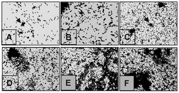 Kinetics of Stenotrophomonas maltophilia adherence to plastic. (A) As early as 30 min, individual bacteria have attached to the plastic surface and formed small clumps (arrows). (B–D) As incubation time proceeds for 1 (B), 2 (C), and 4 (D) h, the number of attached bacteria increases throughout the abiotic surface. (E) At 6 h, the bacterial monolayers progress into three-dimensional microcolonies (arrows). (F) After 18 h, the microcolonies have formed true bacterial communities. No obvious differences were noted beyond this incubation period. Magnification 400x.