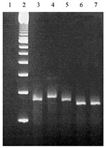 Thumbnail of Ethidium bromide stained 3% molecular screening agarose gel containing Bordetella pertussis DNA amplified with primers QH8F´ and QH2R. Lanes: 1, negative control including all reagents but no template DNA; 2, 100-bp ladder; 3, B. pertussis strain 1772 of type prn1 (260 bp); 4, Bordetella pertussis clinical isolate of type prn2 (275 bp); 5, B. pertussis clinical isolate of type prn3 (260 bp); 6, B. pertussis clinical isolate of type prn4 (245 bp); and 7, B. pertussis type prn5 (245 b