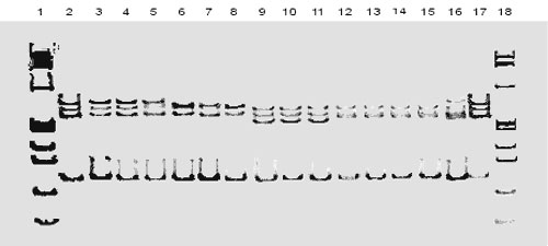 Representative polymerase chain reaction single-stranded conformational polymorphism (SSCP) patterns of rifampin resistance in Mycobacterium tuberculosis strains. Lanes: 1, 18, molecular weight 174ΦΧHaeIII; lanes: 2, 17, M. tuberculosis rifampin-susceptible control strain H37Rv; lanes 3, 4, 5 (MICs 2,8,64 µg/mL), pattern 1 rifampin-resistant strains with a pattern indistinguishable from that of M. tuberculosis H37Rv; lanes 6,7,8 (MICs 2, 8, 2,048 µg/mL), pattern 2a; lanes 9,10,11 (MICs 2048, 256