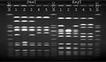 Thumbnail of Pulsed-field gel electrophoresis profiles of SmaI- and EagI-Digested DNA. NCTC, National Collection of Type Cultures 8325 control. Lane 1, patient's oxacillin-resistant vancomycin-intermediate Staphylococcus aureus (VISA); lane 2, patient's oxacillin-susceptible VISA; lane 3, patient's oxacillin-resistant S. aureus (ORSA, vancomycin MIC = 2 µg/mL) from anterior nares; lanes 4 and 5, isolates of ORSA (vancomycin MIC = 2 µg/mL) from the health-care worker's anterior nares.