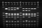Thumbnail of Pulsed-field gel electrophoresis profiles of SmaI digested DNA. NCTC, National Collection of Type Cultures 8325 control. Lane 1, vancomycin-intermediate Staphylococcus aureus (VISA) isolate from Japan, otherwise designated Mu50; lane 2, VISA isolate from Michigan (7); lane 3, VISA isolate from New Jersey (7); Lane 4, VISA isolate from New York (1); lane 5, VISA isolate from Illinois (3); lane 7, patient's oxacillin-resistant VISA; lane 8, patient's oxacillin-susceptible VISA; lane 9