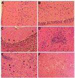 Thumbnail of Histologic changes in brains of West Nile virus-infected hamsters. A. Cerebral cortex, with many degenerating neurons, day 6 postinfection. B. Hippocampus, showing large neurons undergoing degeneration, day 6. C. Cerebellar cortex, with frequent Purkinje call degeneration (shrunken cells, arrowheads) and loss, day 8. D. A microglial nodule near blood vessel in basal ganglia, day 9. E. Mild perivascular inflammation (upper left field), neurons with nuclear condensation (arrowhead) an