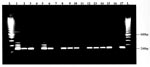 Thumbnail of Visualization of reverse transcription-nested polymerase chain reaction product. West Nile virus-positive samples are indicated by a 248-bp band. Lane 1: positive crow brain, NY, 1999. Lane 2: positive crow kidney, NY, 1999. Lane 3: positive Sandhill Crane brain, CT, 1999. Lane 4: negative crow brain. Lane 5-6: positive crow brains, NY, 2000. Lane 7: normal control. Lane 8-10: positive horse brains, NY, 1999. Lane 11: negative horse brain. Lane 12: positive horse brain, RI, 2000. La