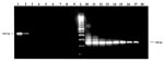 Thumbnail of Visual comparison of first stage reverse transcription-polymerase chain reaction (RT-PCR) amplification products with RT-nested (n) PCR amplification products. Lanes 1-9 represent first-stage products of 10-fold dilutions 10-1 through 10-9. Lanes 10-18 represent nested amplification products of same dilutions. L: 100-bp DNA ladder.