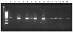 Thumbnail of Species-specific gel electrophoresis of La Crosse virus-positive mosquito pools from Tennessee and North Carolina and Aedes albopictus pools with varying degrees of Ochlerotatus triseriatus contamination. Lane 1, 100-bp ladder; lane 2, Oc. triseriatus pool with Oc. triseriatus primers; lane 3, Oc. triseriatus pool with Aedes albopictus primers; lane 4, Ae. albopictus pool with Ae. albopictus primers; lane 5, Ae. albopictus pool with Oc. triseriatus primers; lane 6, Ae. albopictus po