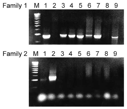 Polymerase chain reaction for PspA families 1 and 2: lanes 1 and 2 were controls for families 1 and 2, respectively. Lanes 3 to 7 and 9 (Co-24, Co-25, Co-26, Co-27, Co-28, Co-29, Co-30 isolates) were family 1. Lane 8 (Co-29) did not amplify with either family. The molecular weight was 1-kb ladder DNA (Promega).