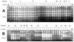 Thumbnail of Amplification fragment length polymorphism analysis analysis of the Enterobacter cloacae and Escherichia coli integron amplicons. A. AluI restriction fragment length polymorphism (RFLP) patterns for the integrons amplified from the E. cloacae strains. Patients and strains are identified above the lanes. Lanes marked M contain molecular length markers; the 200-bp fragment is identified on the left. Two different patterns are identified: only strains 11-2, 5-1, 5-2, 5-3, and 10-1 show