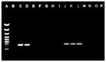 Thumbnail of Polymerase chain reaction (PCR) products formed from total DNA of lactococcal strains with primers LLF and LLR. Lane A, molecular size marker; lane B, negative control. Lactococcus lactis subsp. lactis ATCC 19435 (lane C), L. lactis subsp. lactis ATCC 11007 (lane D), and the clinical isolates (lanes J, K, and L) generated a PCR amplification product of 650 bp. No amplification was observed from L. garvieae NCFB 2155 (lane E), clinical isolates of L. garvieae (lanes F, G, H and I), L