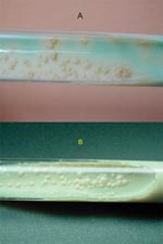 Thumbnail of Colony morphology on Löwenstein-Jensen slants, showing M. canetti and M. tuberculosis strains. (A) Colonies of M. tuberculosis are rough, thick, wrinkled, have an irregular margin, and are faintly buff-colored. (B) M. canetti exhibits smooth, white and glossy colonies.