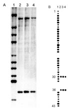 Thumbnail of (A) IS6110 hybridization patterns of PvuII-digested genomic DNA. Lane 1, Mycobacterium tuberculosis Mt 14323 (reference strain). Lane 2, M. canetti strain NZM 217/94. Lanes 3 and 4, the strains isolated from French legionnaires with pulmonary tuberculosis (TB). (B) Spoligotyping patterns. Lane 1, M. tuberculosis H37Rv (reference strain). Lane 2, M. canetti strain NZM 217/94. Lanes 3 and 4, the strains isolated from French legionnaires with pulmonary TB.