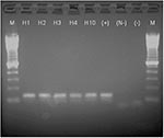 Thumbnail of Results on 1.5% agarose gel of reverse tranferase–polymerase chain reaction (RT-PCR) products stained with ethidium bromide and imaged under UV light. M: 100-bp marker; H1–4, H10: horses 1–4 and 10; (+): positive control viral RNA, 1.8 x 102 PFU amplified; (N-): negative control for nested PCR (-); negative control from single round RT-PCR. All horse samples and the positive control show a band at the expected size (134 bp), and negative controls show only the primers (below 100 bp)