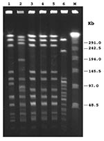 Thumbnail of Pulsed-field gel electrophoresis patterns of ApaI-digested chromosomal DNAs of Haemophilus influenzae isolates. Lanes 1–5, H. influenzae type e (Hie) isolates, respectively, from patient nos. 1–5; lane 6, H. influenzae type b (Hib) strain belonging to one of the subclones endemic in Italy (9); M, λ ladder pulsed-field gel marker with molecular weights indicated in kilobases (kb) at the right. The isolates in lanes 3, 4, and 5 showed indistinguishable profiles (pattern 1); the isolat