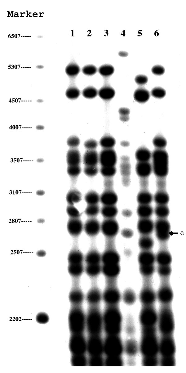 Polymorphic guanine cytosine-rich repetitive sequence restriction fragment length polymorphism results of six zero-copy IS6110 strains. Lanes 1–6 represent the six cases reported in this study. The arrow indicates an additional band at 2,760 bp in isolate 6 compared to lanes 1–3.