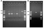 Thumbnail of A: Polymerase chain reaction (PCR) amplification products with primers targeted against the class 1–specific conserved sequences. Lane 1: no template control; lane 2: positive control (In2); lane 3: Escherichia coli isolate 16; lane 4: E . coli isolate 19; lane 5: E. coli isolate 21; lane 6: blank; lane 7: E. coli isolate I-6. B: PCR amplification products with primers targeted against the class 2–specific conserved sequences. Lane 1: no template control; lane 2: positive control (I