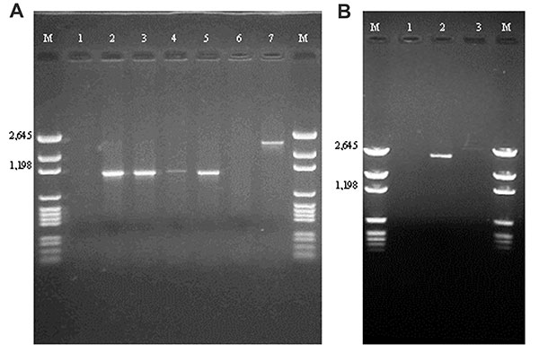 A: Polymerase chain reaction (PCR) amplification products with primers targeted against the class 1–specific conserved sequences. Lane 1: no template control; lane 2: positive control (In2); lane 3: Escherichia coli isolate 16; lane 4: E . coli isolate 19; lane 5: E. coli isolate 21; lane 6: blank; lane 7: E. coli isolate I-6. B: PCR amplification products with primers targeted against the class 2–specific conserved sequences. Lane 1: no template control; lane 2: positive control (In2); lane 3: