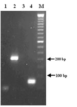 Thumbnail of RT-PCR detection of West Nile virus RNA in cerebrospinal fluid. Lanes 1 and 3: negative controls; lanes 2 and 4: cerebrospinal fluid; lane M: 50-bp DNA ladder. Primer pairs used: lanes 1 and 2: CU9093/CL9279; lanes 3 and 4: D87F/D156R.