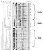 Thumbnail of Pulsed-field gel electrophoresis patterns of meningococcal serogroup C strains isolated from persons &lt;15 years of age (panel A), persons 15–24 years (panel B), and adults &gt;25 years of age (panel C) during 1992–1999. Culture date and sequence type are listed to the right of the dendrogram.