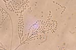 Thumbnail of Divergent phialides and long, tangled chains of elliptical conidia borne from more complex fruiting structures characteristic of Paecilomyces lilacinus, 460X.