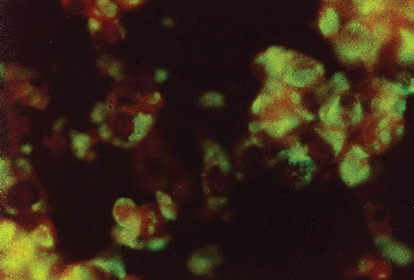 Indirect immunofluorescence antibody testing with monoclonal antibodies identifying dengue-1 virus in tissue culture of Vero cells.