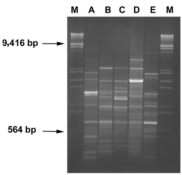 RAPD profiles of blaVIM positive strains. Amplification products (8 μL) obtained with primer 208 (5′-ACGGCCGACC-3′) (14) were run on 2% agarose gel. Lanes A-E: RAPD-types as indicated in Table 1. Lanes M: λDNA digested with EcoRI and HindIII.