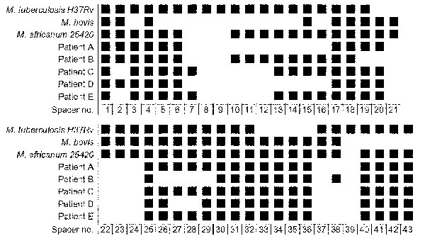 Spacer oligonucleotide typing (spoligotyping) results for cultures from patients A through E, together with representative patterns from stock cultures of Mycobacterium tuberculosis complex species. Spoligotypes for patients C and E are identical.