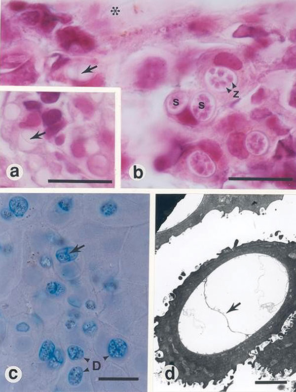a and b, histopathologic findings from infected frogs. Characteristic sporangia (s) containing zoospores (z) are visible in the epidermis (asterisk, superficial epidermis; arrow, septum within an empty sporangium; bars, 10 μm. c, Skin smear from infected frog, stained with 1:1 cotton blue and 10% aqueous potassium hydroxide (aq KOH) (D, developing stages of Batrachochytrium dendrobatidis; arrow, septum within a sporangium; bar, 10 μm. d, Electron micrograph of an empty sporangium showing diagnos
