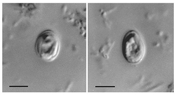 Nomarski interference contrast photomicrographs of Cryptosporidium muris from the feces of an HIV-positive human. Scale bars = 5 μm.