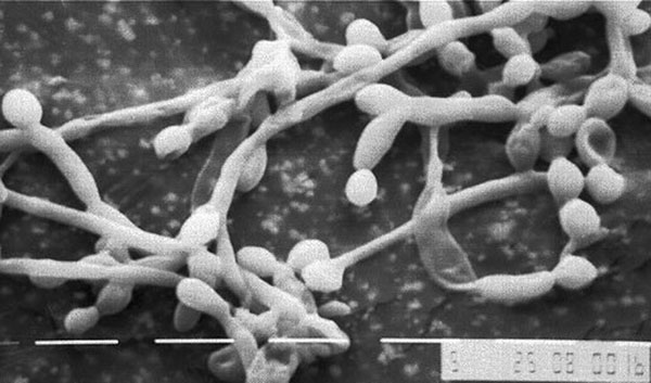 Typical field found in scanning electron micrograph of biofilm formed by Candida albicans on intravascular disc prepared from catheter material.
