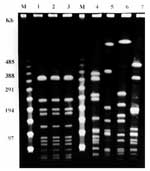 Thumbnail of Pulsed-field gel electrophoresis patterns of the three clinical isolates of levofloxacin-resistant Haemophilus influenzae from the case report (lanes 1 to 3) and four control cases of levofloxacin-susceptible H. influenzae biotype II strains isolated from the same geographic area (lanes 4 to 7). Lane 1: strain 32602 (blood); lane 2: strain 35102 (blood); lane 3: strain 35202 (bronchial aspirate); lane 4: pleural fluid isolate; lane 5: blood isolate; lane 6: pleural fluid isolate. M,