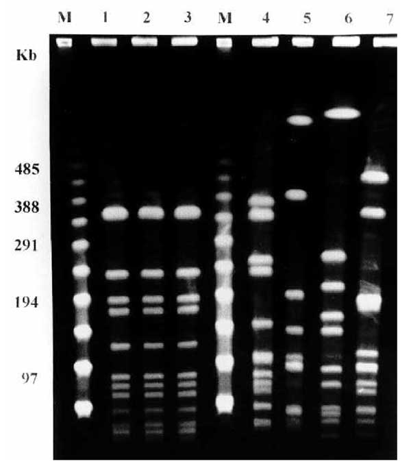 Pulsed-field gel electrophoresis patterns of the three clinical isolates of levofloxacin-resistant Haemophilus influenzae from the case report (lanes 1 to 3) and four control cases of levofloxacin-susceptible H. influenzae biotype II strains isolated from the same geographic area (lanes 4 to 7). Lane 1: strain 32602 (blood); lane 2: strain 35102 (blood); lane 3: strain 35202 (bronchial aspirate); lane 4: pleural fluid isolate; lane 5: blood isolate; lane 6: pleural fluid isolate. M, molecular ma